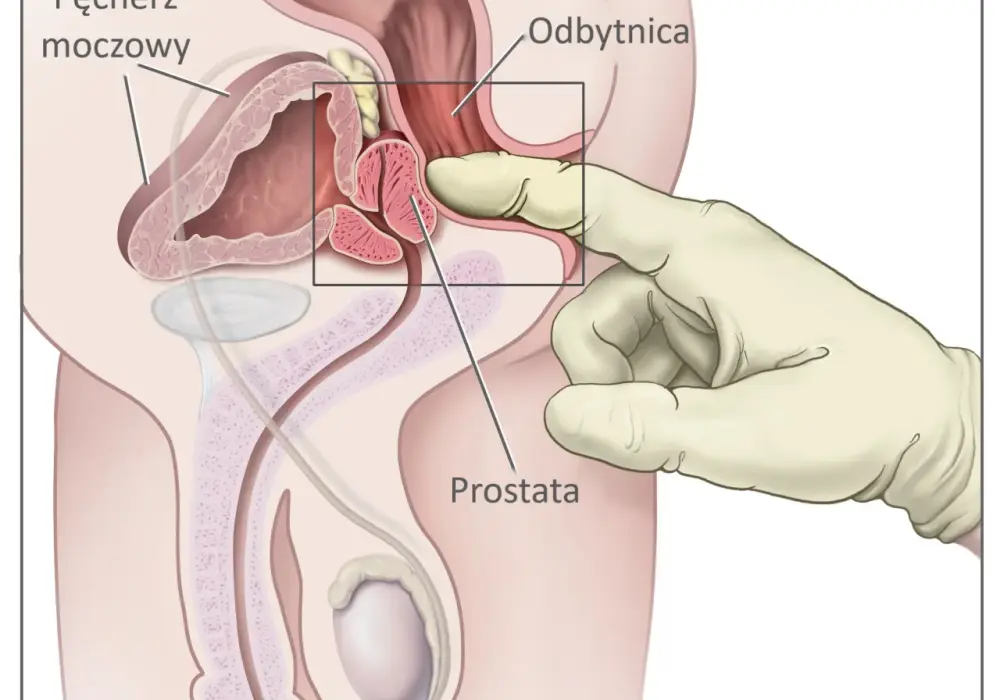 Badanie odbytu u mężczyzn: co warto wiedzieć przed pierwszą wizytą