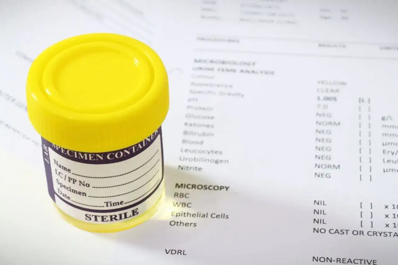 Zdjęcie Ureaplasma badanie u mężczyzn: kompleksowy poradnik diagnostyczny